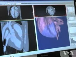 3D Printers Help Heart Surgeons